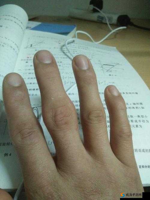 才三根手指就痛且引发不适
