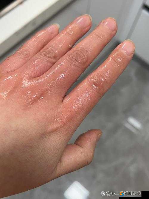 硬了一晚上睾丸疼：恢复时间因人而异