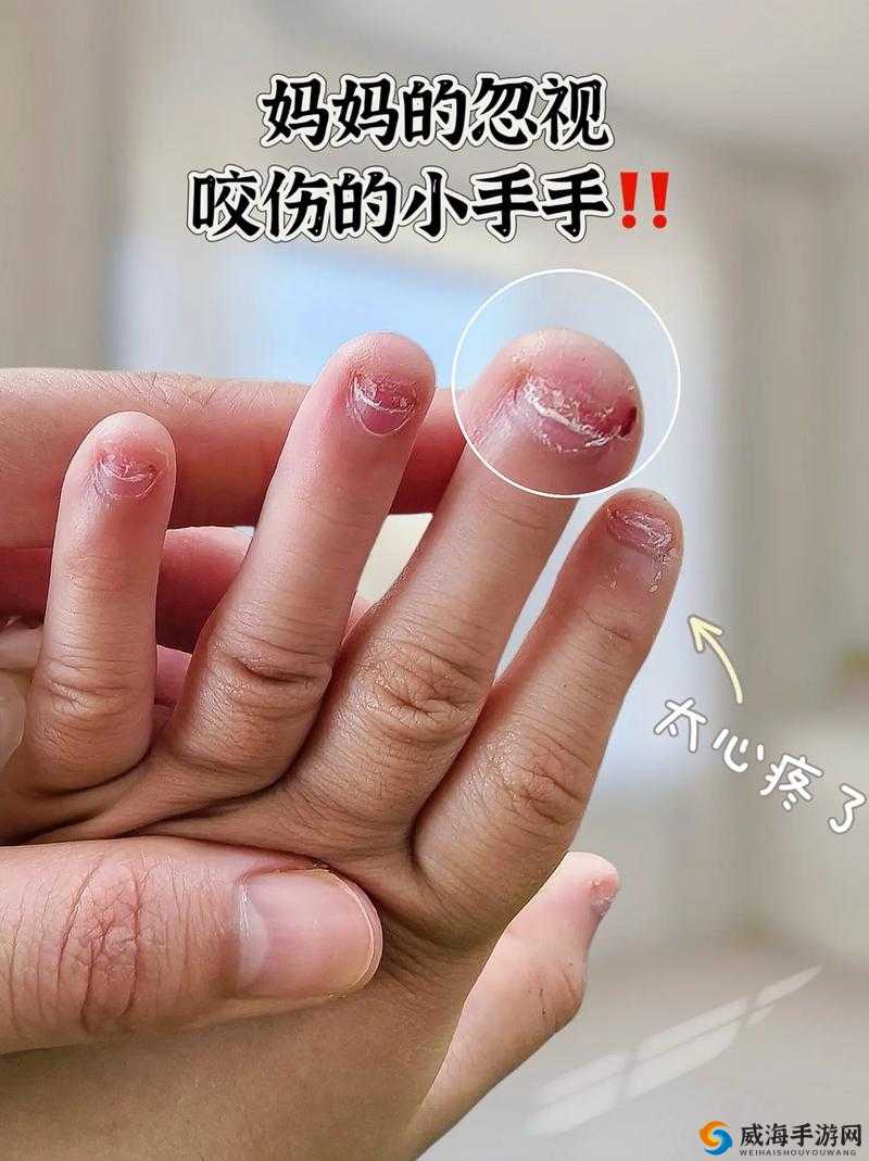 为什么手指划入缝隙挖水的原因探究