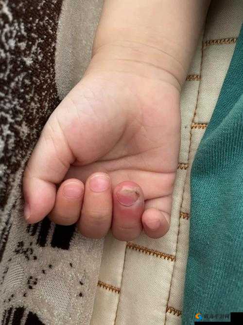宝宝才两根手指就哭了：原因何在