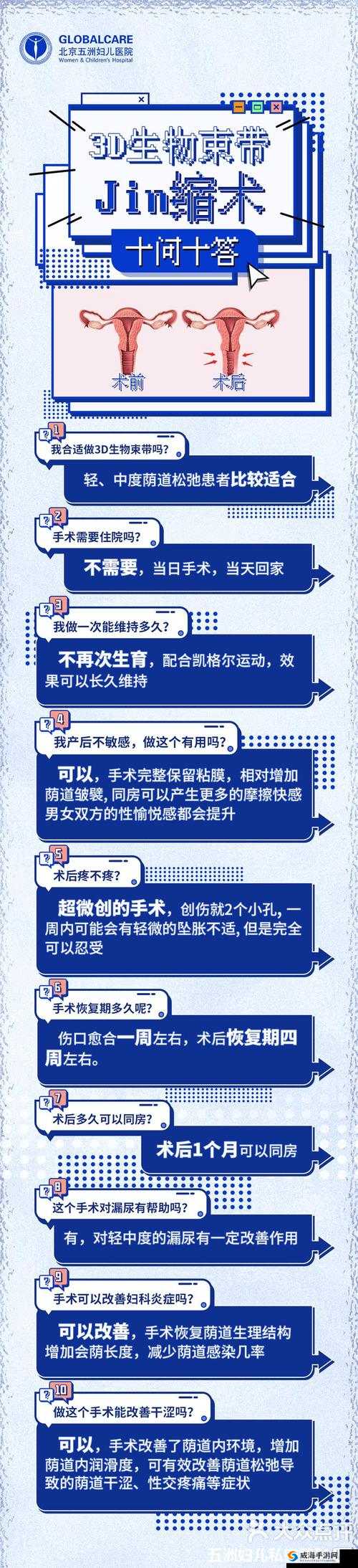 3D 生物束带紧缩术能维持几年：与相关影响因素探讨