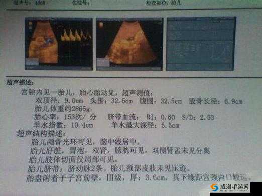 做 b 超医生从哪判断性别-探究其判断依据及相关专业知识
