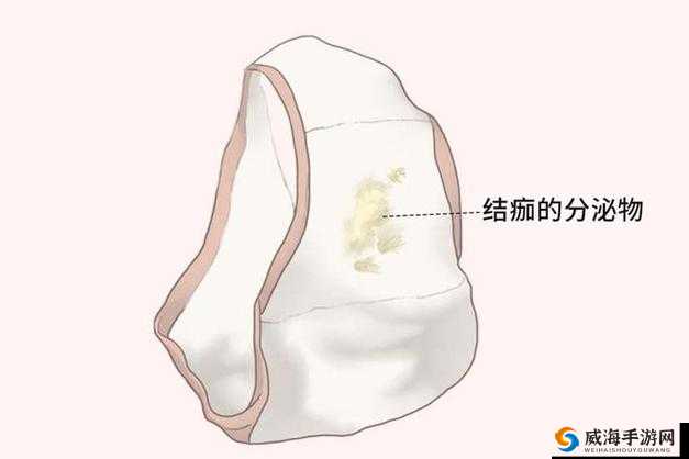 破苞后性行为导致出血:需关注的重要健康警示