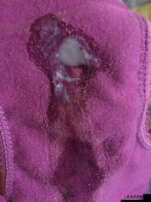 18 岁少女破处后流出大量白色液体，究竟是怎么回事？