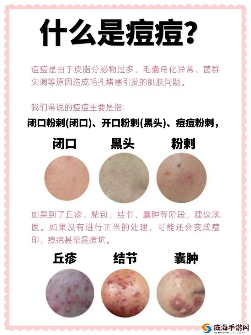 女生流出白白的东西怎么回事：需引起重视的身体信号
