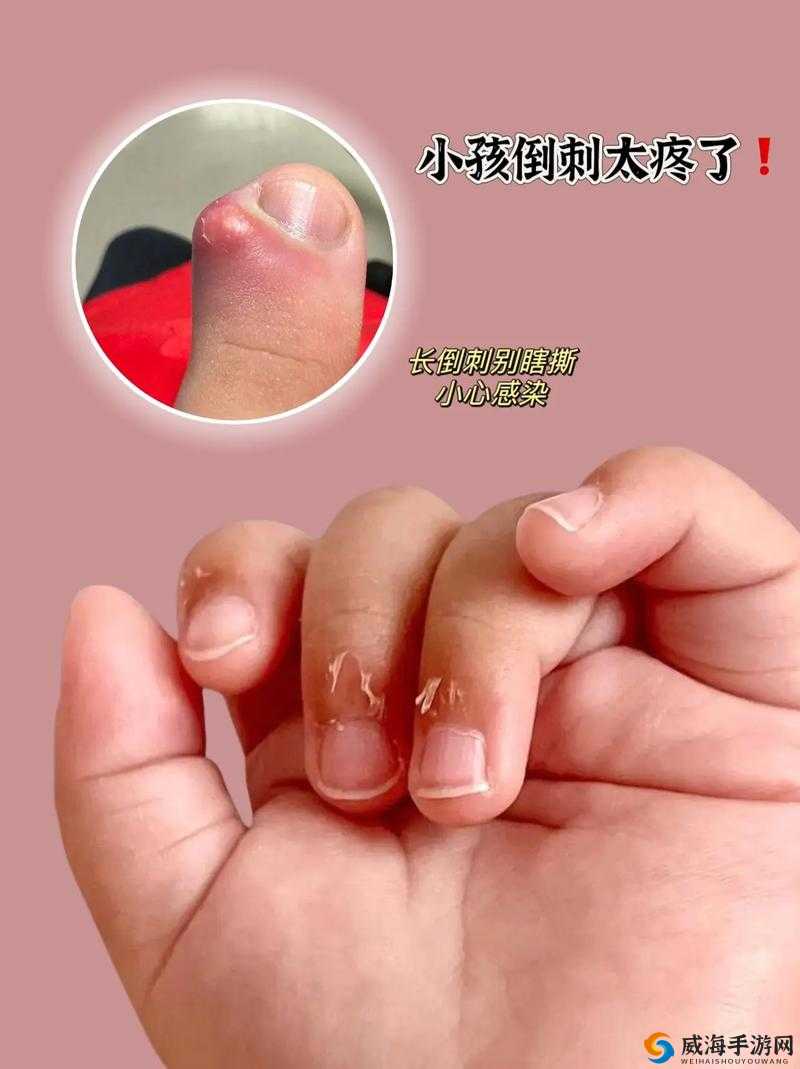 宝宝下面都湿透了还嘴硬疼咋回事到底是怎么了呀