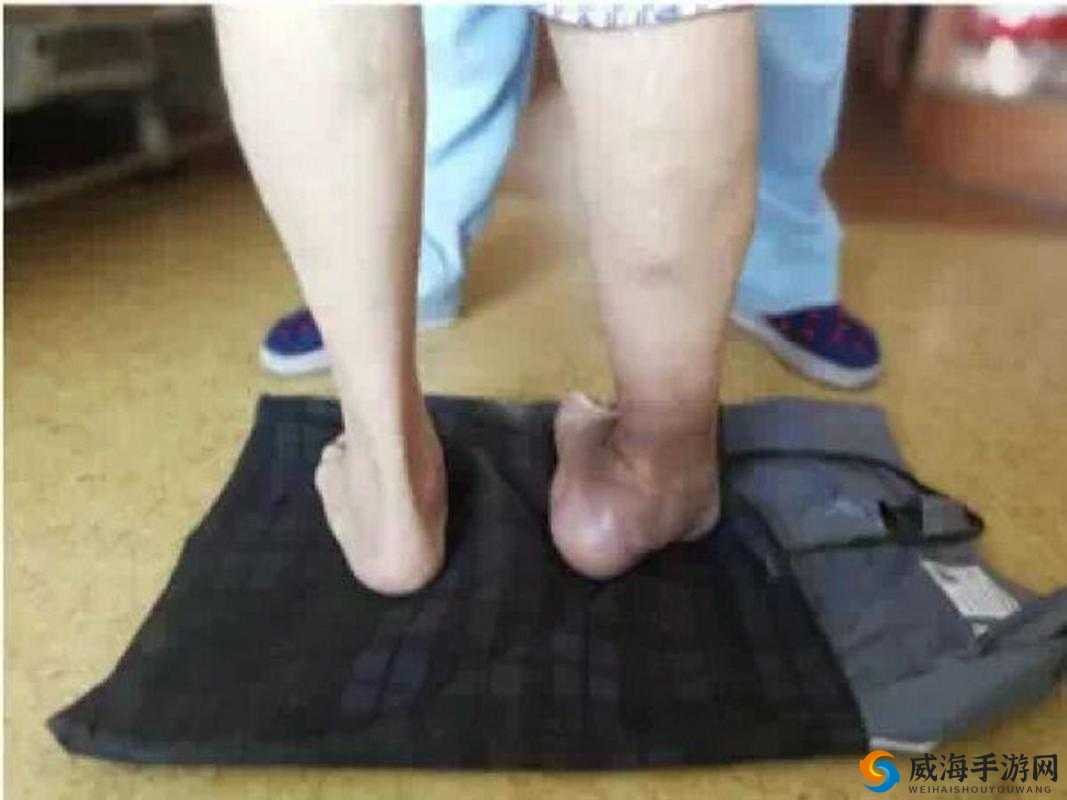 被黑人扒开双腿猛进夏科骨科：骨科专家揭秘罕见病例
