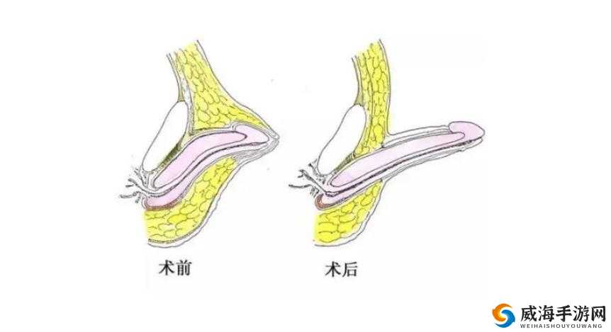 男生将生殖器强行扎入女生生殖器相关事件引发关注