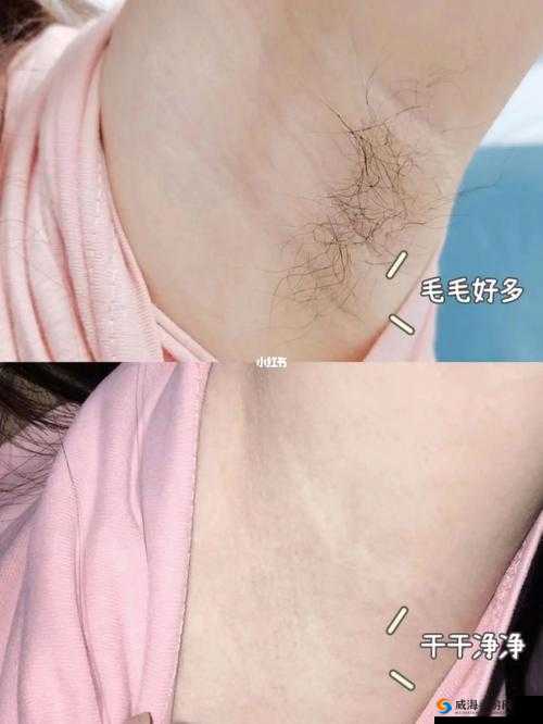 妈妈美白蚌埠究竟是不是私人的呢