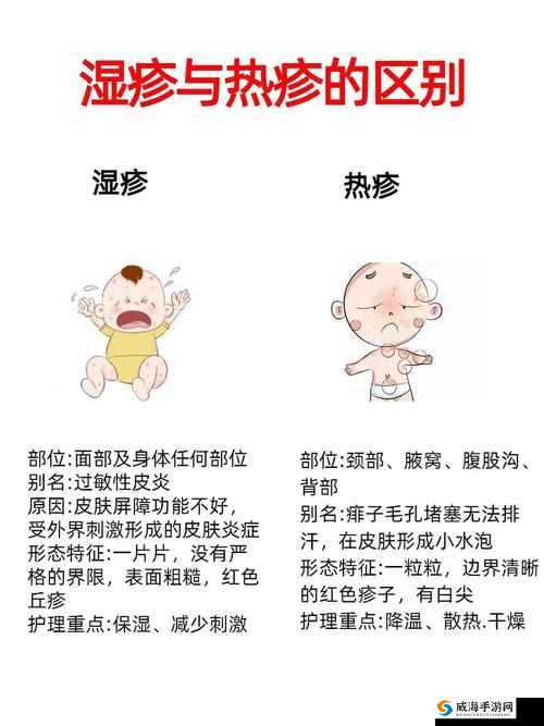 宝宝湿透了还嘴硬疼怎么回事？家长必看的常见原因与应对方法解析