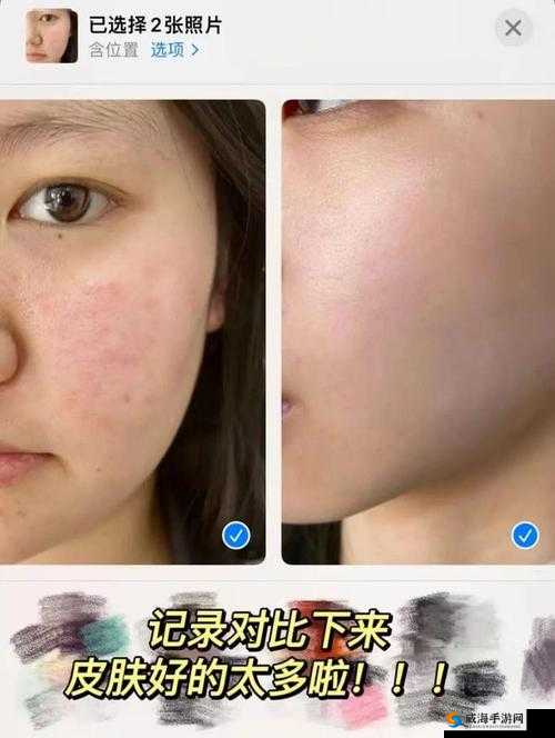 上面亲一个面膜的使用效果如何？真实体验分享与护肤心得大揭秘