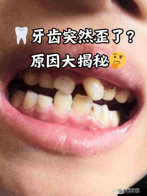 被顶坏了怎么办？常见原因及解决方法大揭秘，助你快速修复问题