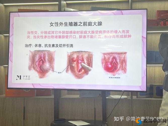 为什么同房后女生下面会痒？这些原因你需要知道