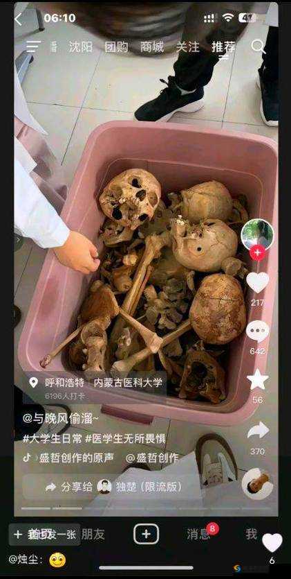 探索真人头颅标本的奥秘：详细解剖结构与医学教育应用全解析