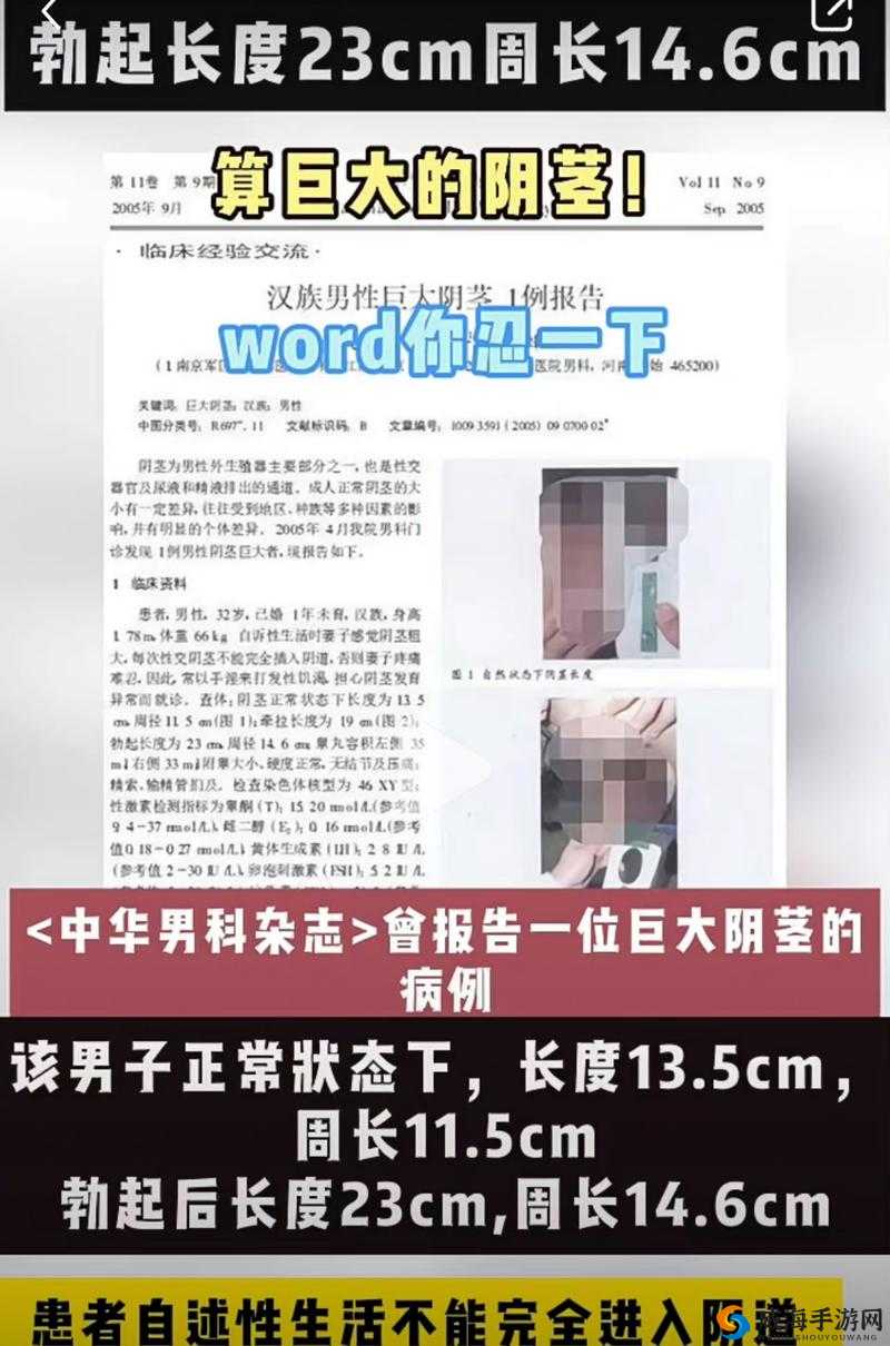 惊人发现男人生殖长35cm图片引发热议，真实情况究竟如何？网友纷纷围观讨论