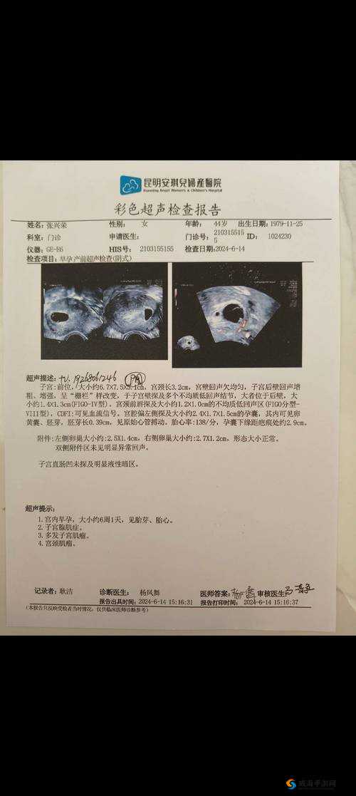 体检B超医生当场提醒：关键指标异常需及时关注，健康不容忽视