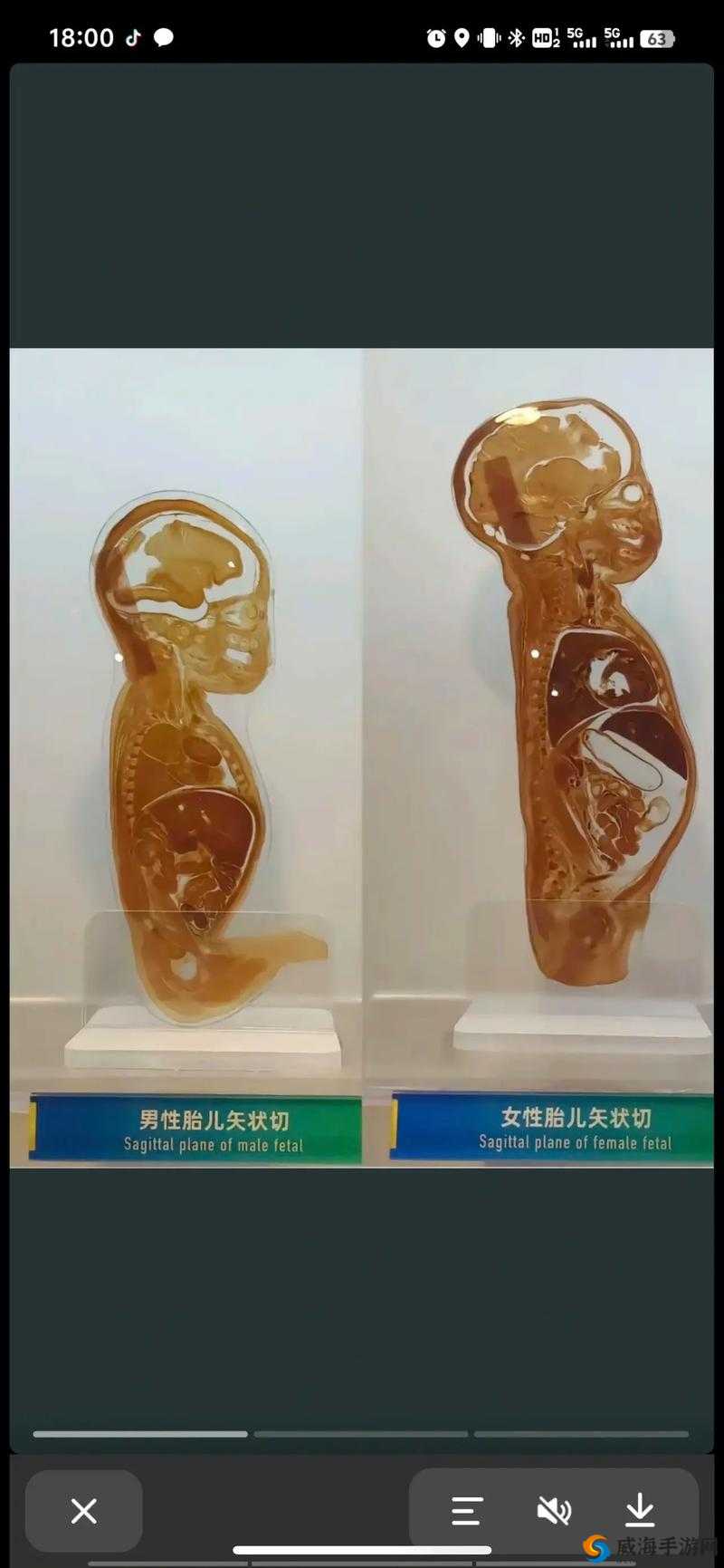 胎儿性别早暗示你了，究竟有哪些暗示？快来一探究竟