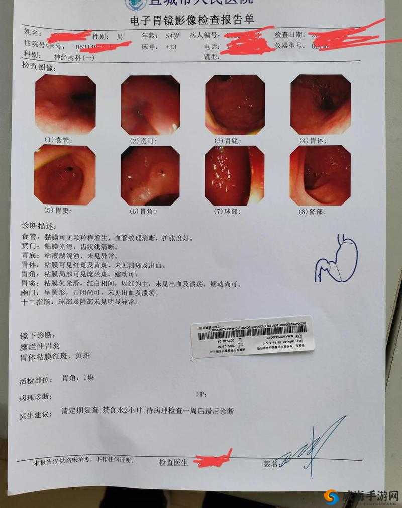 17c14·cv 是什么意思？带你深入了解 17c14·cv 的奥秘与作用