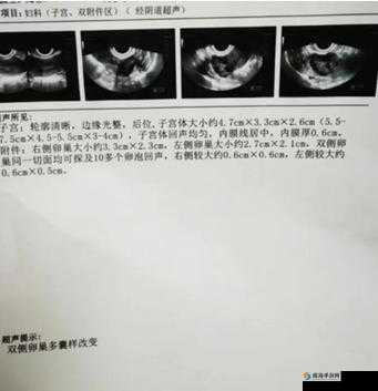 17c·Cm359 是什么意思？其背后有着怎样的含义与价值？快来一探究竟